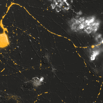 Animated GIF of Mitochondrial Trafficking in Sensory Neurons