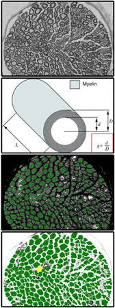 G-ratio Measurements in Mouse Seral Nerve