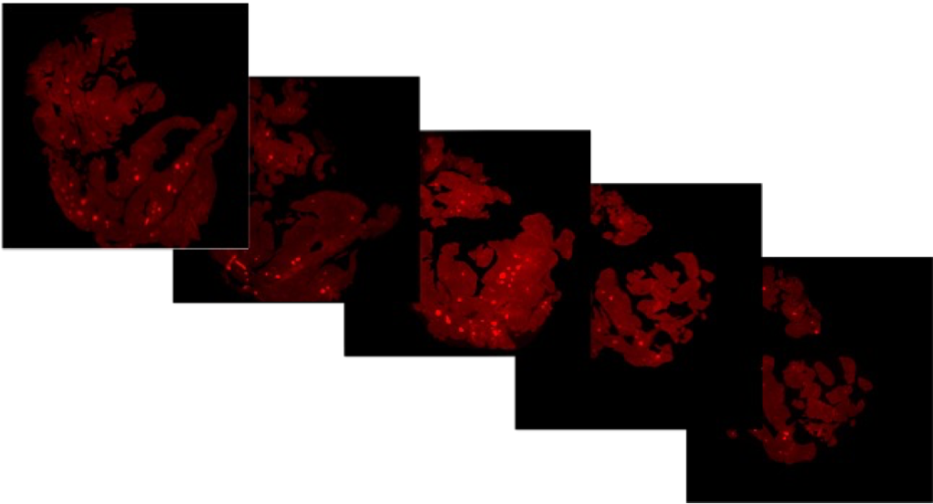 beta-cell-mass-multiple-images
