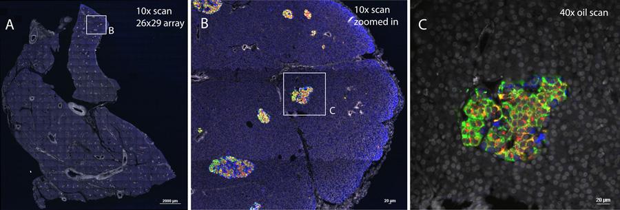 Banner with three images, showing detail of islets in human pancreas tissue