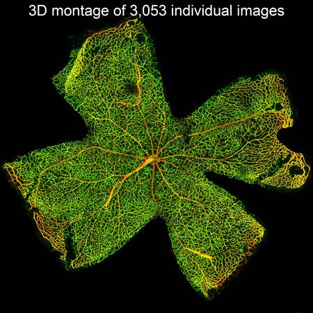 Large Format Stitched Retina Flat Mount