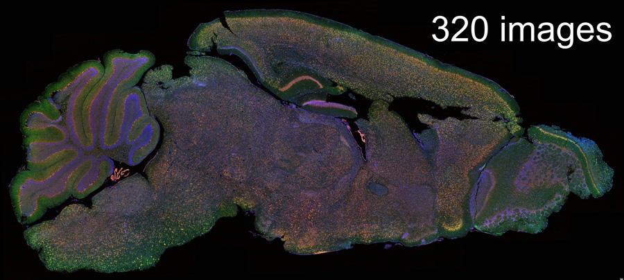  Large Format Stitched Parasagittal Brain Section