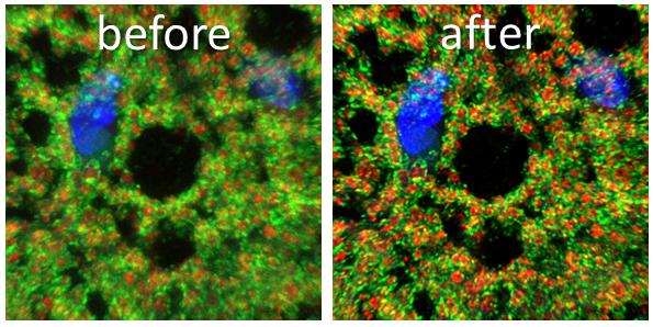 Mitochondria in adipose tissue