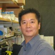 Nonalcoholic fatty liver disease, hepatic energy metabolism, diabetes