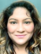 Neurorestorative Responses to Delayed Human Mesenchymal Stromal Cells Treatment of Stroke in Type 2 Diabetes